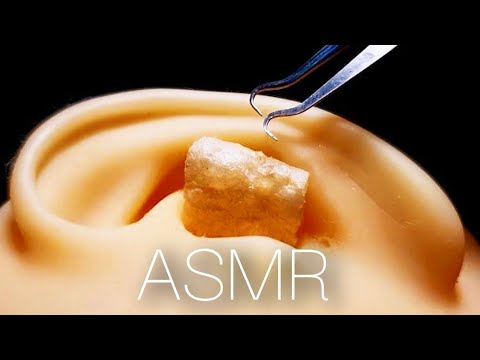 Видео: Чистка ушей с помощью ASMR Tingle, которая правильно передает текстуру хрустящей ушной серы