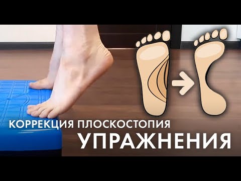 Видео: Плоскостопие: упражнения для детей и взрослых от плоскостопия