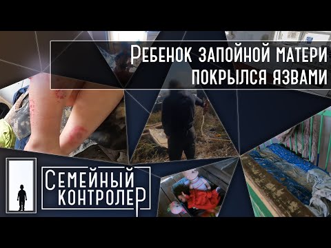 Видео: Ребенок запойной матери покрылся язвами | Семейный контролер