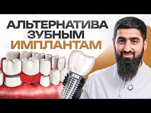 Видео: Чем заменить зубные импланты? Современная альтернатива имплантации зубов