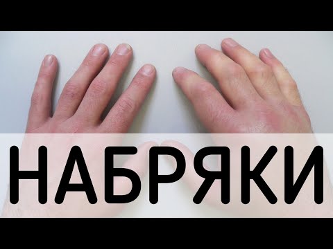 Видео: ФІЗІОЛОГІЯ / ЛЕКЦІЯ / КРОВ / 4
