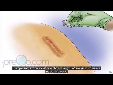 Видео: Догляд за ранами • Wound Care Discharge Surgery • PostCare™ Patient Education