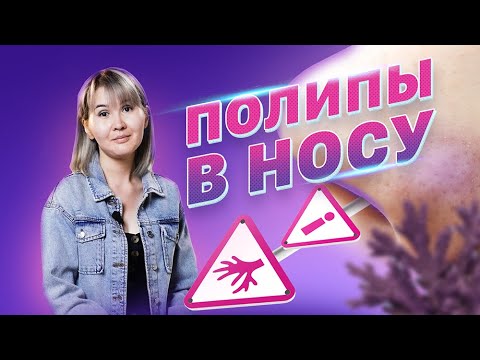 Видео: Полипы полости носа и околоносовых пазух