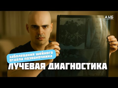 Видео: ЛЕКЦИЯ ДЛЯ СПЕЦИАЛИСТОВ: как разобрать МРТ, КТ и рентген шейного отдела позвоночника
