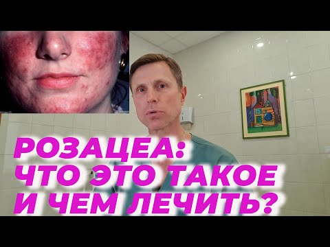 Видео: Розацеа: что это такое и чем лечить.