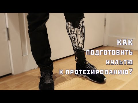 Видео: Как подготовить культю к протезированию?