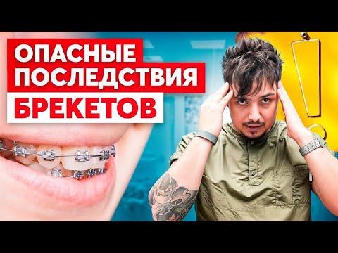 Видео: Офис, стресс и брекеты 💻 Почему они часто ломают тело, а не исправляют его