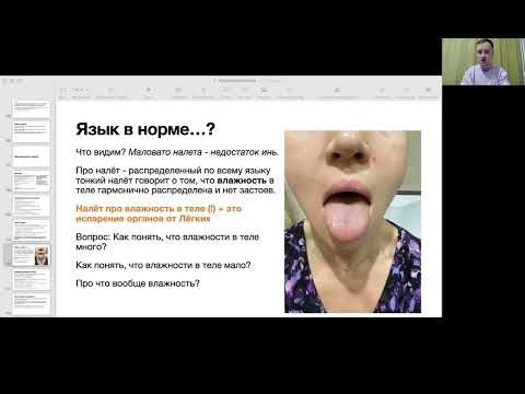 Видео: Диагностика по языку. Китайская традиционная медицина