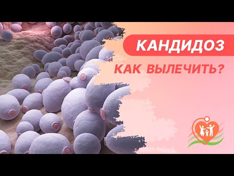 Видео: 🧼  Кандидоз - как вылечить?