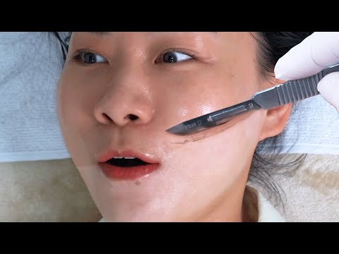 Видео: ASMR | Женское бритье лица | Процедура дермапланинга