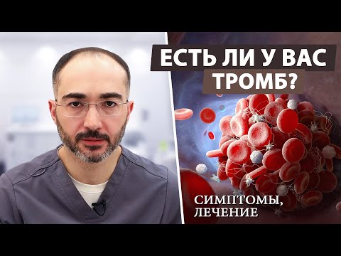 Видео: Как заподозрить у себя тромбоз и что потом делать?