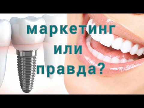 Видео: МГНОВЕННАЯ имплантация зубов. Быстрая ИМПЛАНТАЦИЯ зубов.