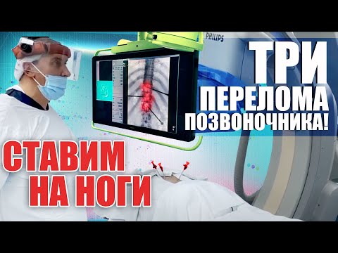 Видео: ДЕНЬ ИЗ ЖИЗНИ НЕЙРОХИРУРГА | Перелом позвоночника, как лечить?