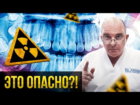 Видео: ОПАСНО ли делать РЕНТГЕН ЗУБОВ? Смотрите подробности...