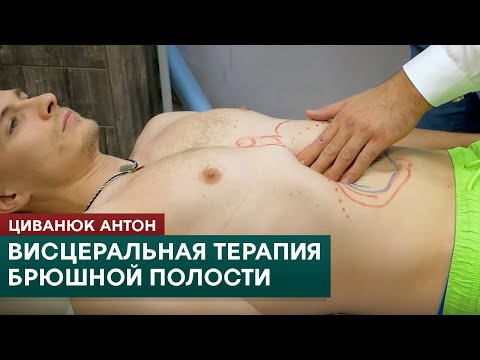 Видео: Висцеральная терапия брюшной полости. Техники коррекции. Циванюк Антон