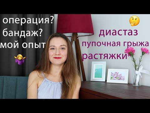 Видео: Восстановление фигуры после родов, диастаз, пупочная грыжа и растяжки. Мой опыт