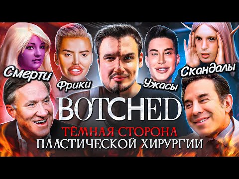 Видео: Тёмная сторона пластической хирургии на ТВ | Грязь, треш, фрики, скандалы и смерти участников