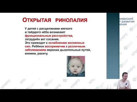 Видео: Консультационный час: «Ринолалия. Отвечаем на вопросы»