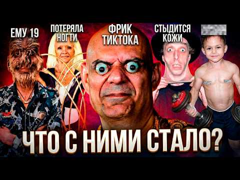 Видео: Книга рекордов Гиннесса - что стало с невероятными людьми? Ничего хорошего?