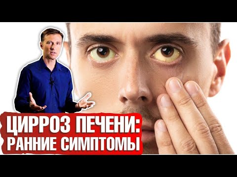 Видео: Цирроз печени: первые симптомы ► Как распознать цирроз печени на ранних стадиях? 🔴