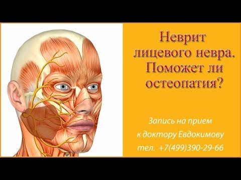 Видео: Неврит лицевого нерва.  Поражение нерва при переохлаждении