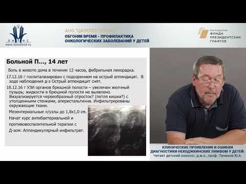 Видео: Клинические проявления и ошибки диагностики неходжскинских лимфом у детей. Часть 1.