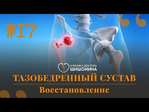 Видео: Как забыть о боли в тазобедренных суставах: отвечает хирург в новом выпуске «Хорошей медицины» ❗️