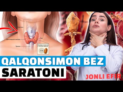 Видео: ҚАЛҚОНСИМОН БЕЗ САРАТОНИ ИЛК БЕЛГИЛАРИ ВА ОЛДИНИ ОЛИШ ЧОРАСИ