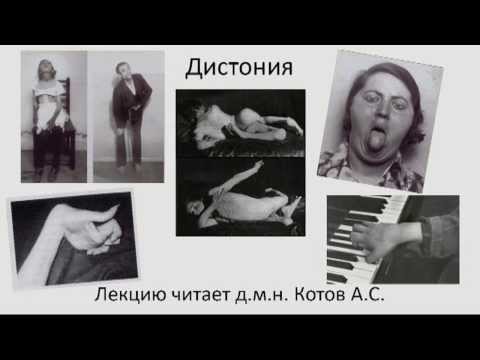 Видео: Дистония