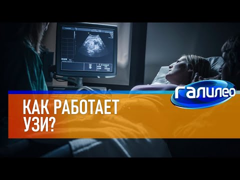 Видео: Галилео 😷 Как работает УЗИ?