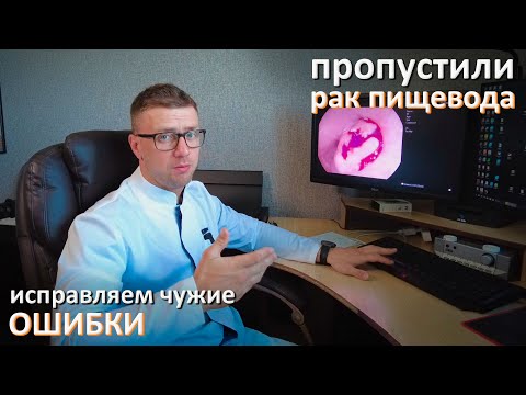 Видео: На гастроскопии пропустили РАК пищевода. Халатность или ошибка?