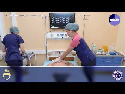 Видео: Отек легких