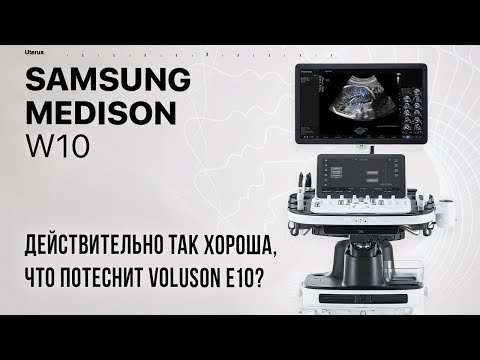Видео: Samsung Medison W10 альтернатива Voluson E10?