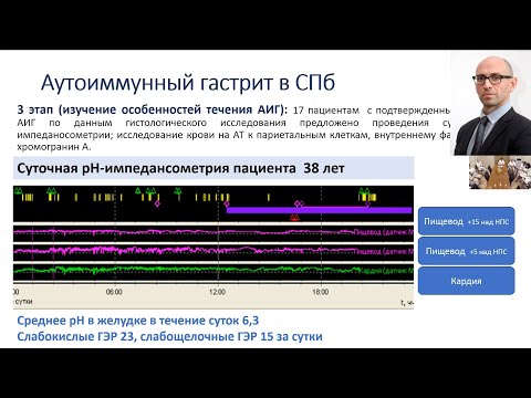 Видео: Тихонов С.В. Аутоиммунный атрофический гастрит. Реальная клиническая практика