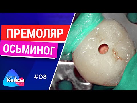 Видео: Премоляр осьминог. #08