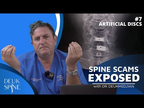 Видео: Осложнения при замене межпозвоночного диска на искусственный. (Эпизод 7: Мошенничество с позвоноч...