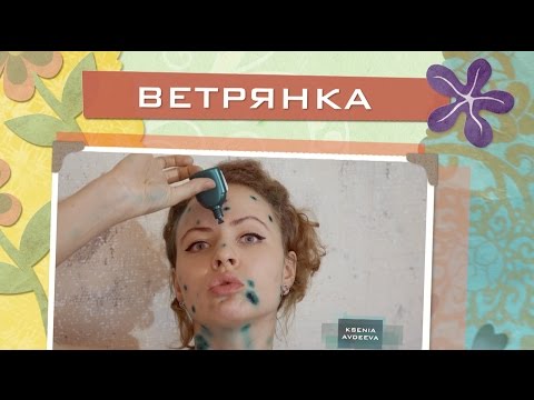 Видео: Ветрянка у взрослых