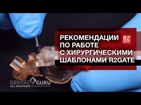 Видео: Рекомендации по работе с хирургическими шаблонами R2Gate