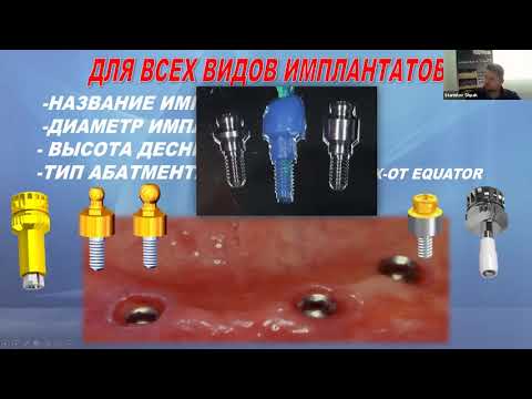 Видео: Съемное протезирование на имплантатах.