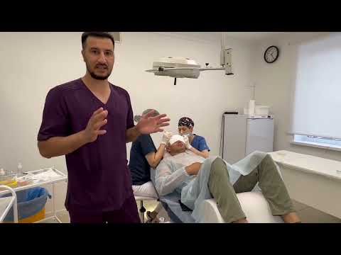 Видео: Пересадка волос в Москве 🔥 Клиника «ОгузМед». +7 (904) 604-85-70