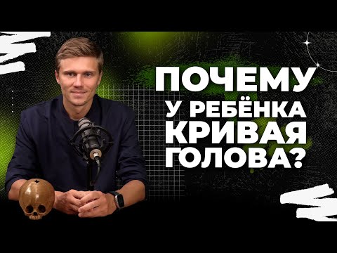 Видео: Краниосиностоз: как лечить, когда лечить и нужно ли лечить?