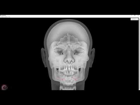 Видео: Медиатека Dental Bot