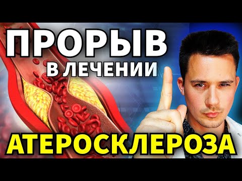 Видео: Атеросклероз.  Новые возможности в лечении! Препарат, который действует иначе.