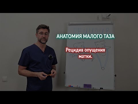 Видео: Рецидив опущения матки