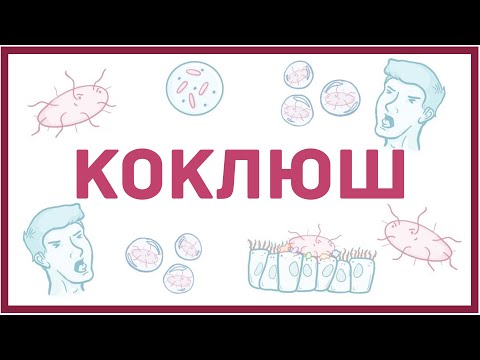 Видео: Коклюш - причины, симптомы, диагностика, лечение