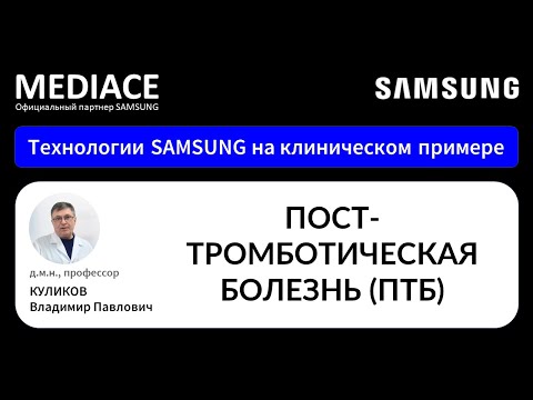 Видео: Посттромботическая болезнь (ПТБ). Протокол УЗИ на клиническом примере