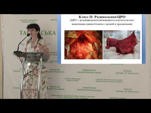 Видео: "Рак яєчника чому ми досі зазнаємо поразки"?