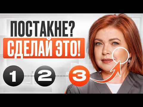 Видео: Как избавиться от ПОСТАКНЕ: 3 простых шага к твоей идеальной коже!