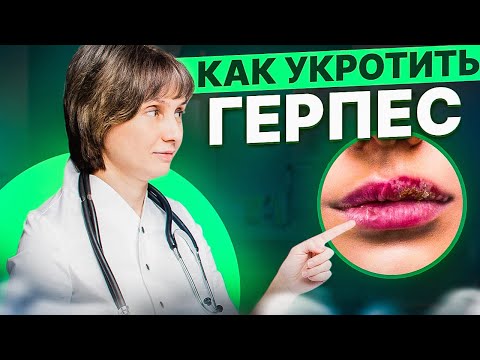 Видео: Как укротить герпес Доктор Лисенкова