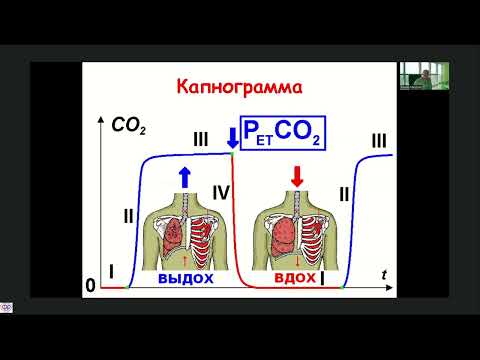 Видео: Капнометрия в ОРИТ Мазурок В.А.